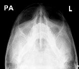 Normal facial bones