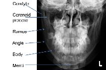 Mandibular anatomy