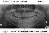 Mandibular anatomy