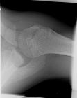 Normal paediatric axial