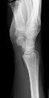 Normal lateral wrist